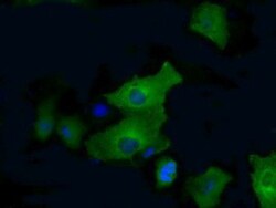 PFKFB4 Antibody (OTI1C8), Novus Biologicals 0.1mL; Unlabeled:Antibodies,