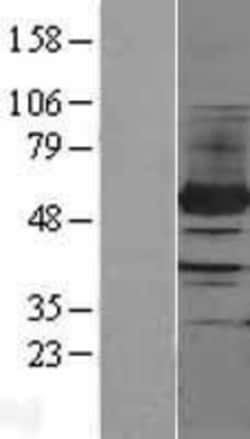 Novus Biologicals&trade;&nbsp;PFKFB4 Overexpression Lysate