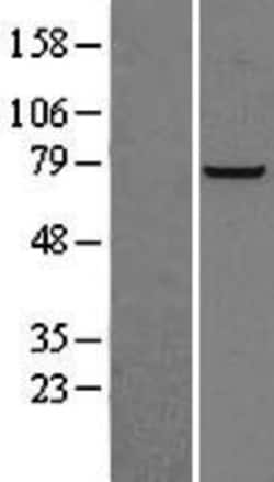 Novus Biologicals&trade;&nbsp;PFKL Overexpression Lysate