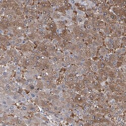 anti-PFKL, Polyclonal, Novus Biologicals 0.1mL; Unlabeled:Antibodies, Polyclonal