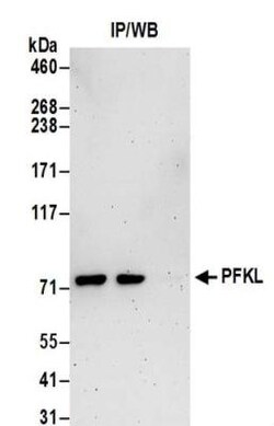 PFKL Antibody, Novus Biologicals 0.1mg; Unlabeled:Antibodies, Polyclonal