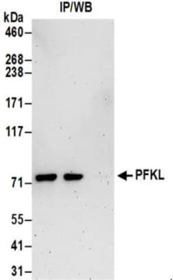 PFKL Antibody, Novus Biologicals 0.1mg; Unlabeled:Antikroppar