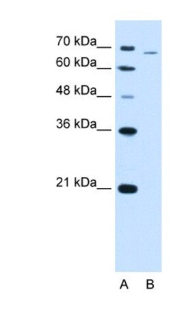 PFKL Antibody, Novus Biologicals:Antibodies:Primary Antibodies