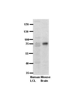 PFKL Antibody, Novus Biologicals:Antibodies:Primary Antibodies