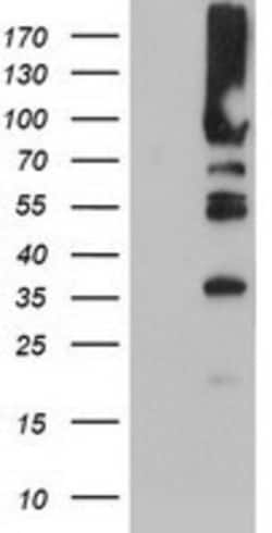 PFKP Antibody (OTI1D6), Novus Biologicals 0.1 mL | Buy Online | Novus Biologicals | Fisher Scientific