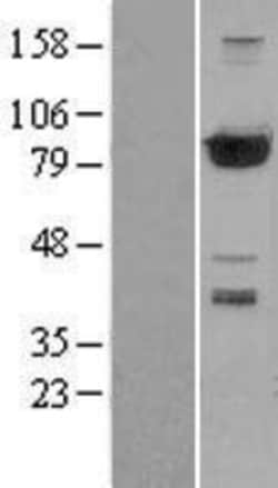 Novus Biologicals&trade;&nbsp;PFKP Overexpression Lysate