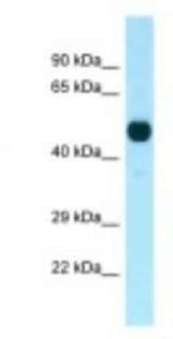 PFTK1 Antibody, Novus Biologicals 100&mu;L; Unlabeled:Antibodies, Polyclonal