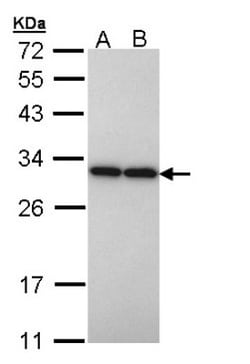 PGAM2 Antibody, Novus Biologicals 0.1mg; Unlabeled:Antibodies, Polyclonal