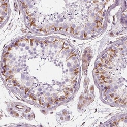 PGAP1 Antibody, Novus Biologicals 0.1mL; Unlabeled:Antibodies, Polyclonal