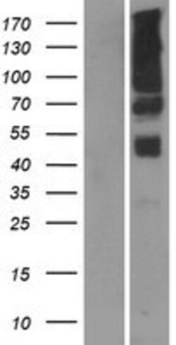 Novus Biologicals&trade;&nbsp;PGAP2 Overexpression Lysate
