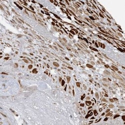 PGBD2 Antibody, Novus Biologicals 25 &mu;L; Unlabeled:Antibodies, Polyclonal