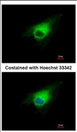 PGD Antibody, Novus Biologicals 0.1 mL | Buy Online | Novus Biologicals | Fisher Scientific