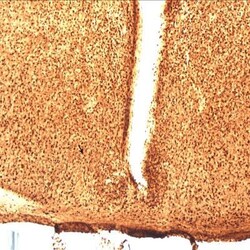 PGD2 Synthase/PTGDS Antibody, Novus Biologicals 0.05mg; Unlabeled:Antibodies,