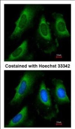 PGK1 Antibody, Novus Biologicals 0.1mL; Unlabeled:Antibodies, Polyclonal