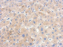 PGK1 Antibody, Novus Biologicals 0.1mL; Unlabeled:Antibodies, Polyclonal