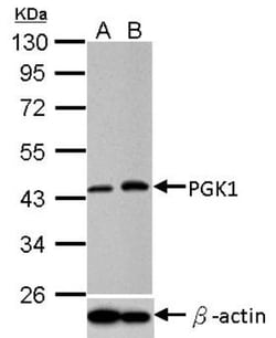 PGK1 Antibody, Novus Biologicals 0.1mL; Unlabeled:Antibodies, Polyclonal