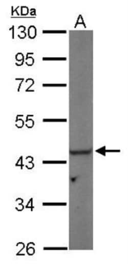 PGK1 Antibody, Novus Biologicals 0.1mL; Unlabeled:Antibodies, Polyclonal