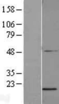 Novus Biologicals™ PGL2 Overexpression Lysate