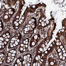 PGL2 Antibody, Novus Biologicals 0.1mL; Unlabeled:Antibodies, Polyclonal