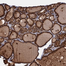 PGLS Antibody, Novus Biologicals:Antibodies:Primary Antibodies