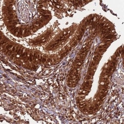 PGLS Antibody, Novus Biologicals 0.1mL; Unlabeled:Antibodies, Polyclonal