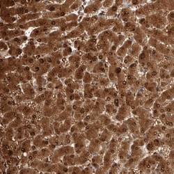 PGM1 Antibody, Novus Biologicals 25 &mu;L | Buy Online | Novus Biologicals | Fisher Scientific