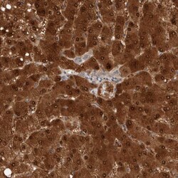 PGM1 Antibody, Novus Biologicals 0.1mL; Unlabeled:Antibodies, Polyclonal