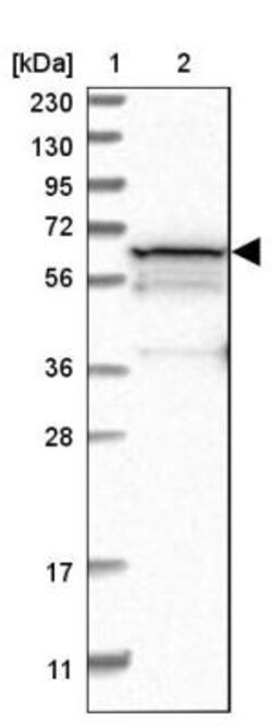 PGM1 Antibody, Novus Biologicals 25 &mu;L | Buy Online | Novus Biologicals | Fisher Scientific