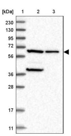 PGM1 Antibody, Novus Biologicals 0.1mL; Unlabeled:Antibodies, Polyclonal