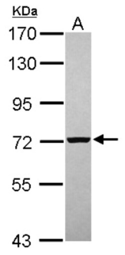 PGM2 Antibody, Novus Biologicals 0.1mL; Unlabeled:Antibodies, Polyclonal