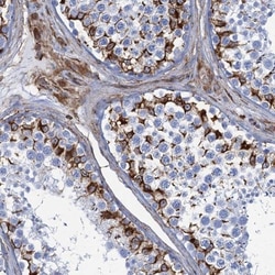 PGM2 Antibody, Novus Biologicals 25 &mu;L, Unlabeled:Antibodies, Polyclonal