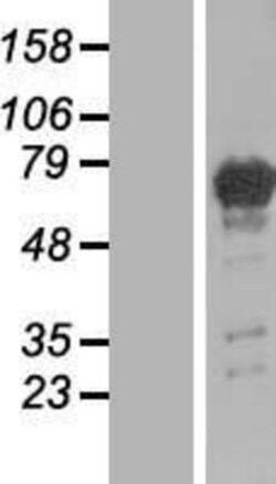 Novus Biologicals&trade;&nbsp;PGM2L1 Overexpression Lysate