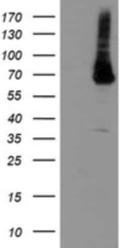 PGM3 Antibody (OTI5C6), Novus Biologicals 0.1mL; Unlabeled:Antibodies,
