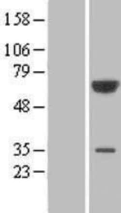 Novus Biologicals&trade;&nbsp;PGM3 Overexpression Lysate