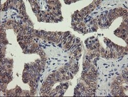 PGM3 Antibody (OTI5C6), Novus Biologicals 0.1mL; Unlabeled:Antibodies,
