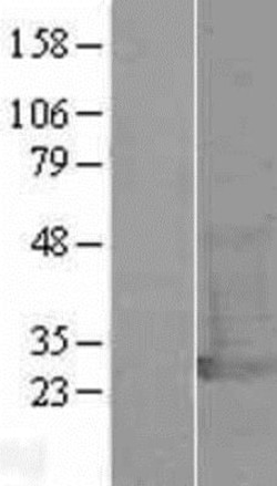 Novus Biologicals&trade;&nbsp;UCH-L1/PGP9.5 Overexpression Lysate