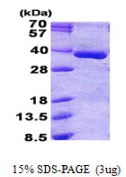 Novus Biologicals&trade;&nbsp;Recombinant Human PGPase His Protein