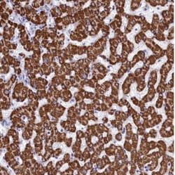 PGPase Antibody, Novus Biologicals:Antibodies:Primary Antibodies