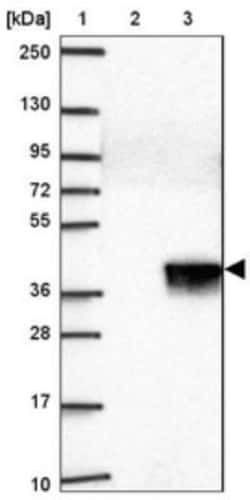 PGPase Antibody, Novus Biologicals:Antibodies:Primary Antibodies