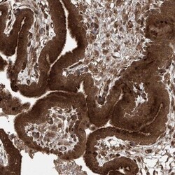 PGPEP-1 Antibody, Novus Biologicals 0.1mL; Unlabeled:Antibodies, Polyclonal