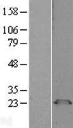 Novus Biologicals&trade;&nbsp;PGRMC1 Overexpression Lysate