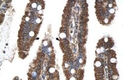 PGRMC1 Antibody, Novus Biologicals 0.05mg; Unlabeled:Antibodies, Polyclonal