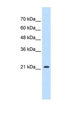 PGRMC1 Antibody, Novus Biologicals 0.05mg; Unlabeled:Antibodies, Polyclonal