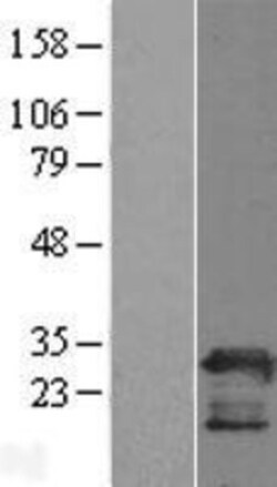 Novus Biologicals™ PGRMC2 Overexpression Lysate