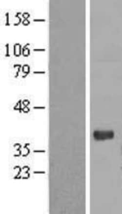 Novus Biologicals™ PGLYRP3/PGRPIA Overexpression Lysate