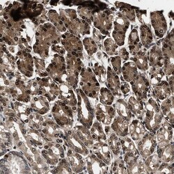 PHACS Antibody, Novus Biologicals:Antibodies:Primary Antibodies
