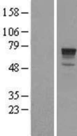 Novus Biologicals&trade;&nbsp;PHACTR1 Overexpression Lysate