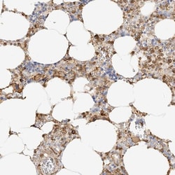 DDX51 Antibody, Novus Biologicals:Antibodies:Primary Antibodies