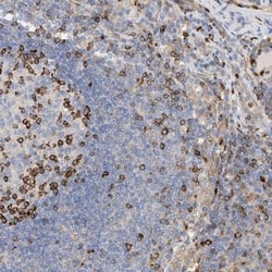 PHACTR2 Antibody, Novus Biologicals 25 &mu;L; Unlabeled:Antibodies, Polyclonal