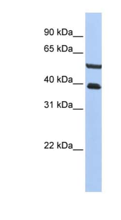 PHACTR3 Antibody, Novus Biologicals 100&mu;L; Unlabeled:Antibodies, Polyclonal